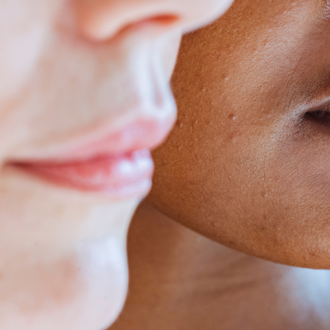 EXFOLIATE